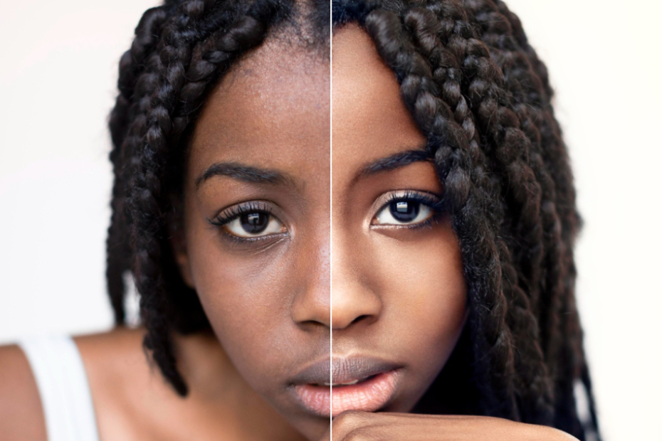 Jeune femme noire avec le teint éclairci et unifié sur la moitié du visage